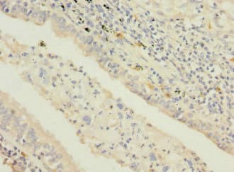 Polyclonal Rabbit anti-Human STAM2 Antibody (IHC, WB)