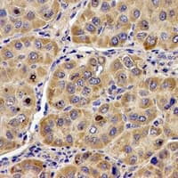 Angiogenin / ANG Antibody (N-Terminus)