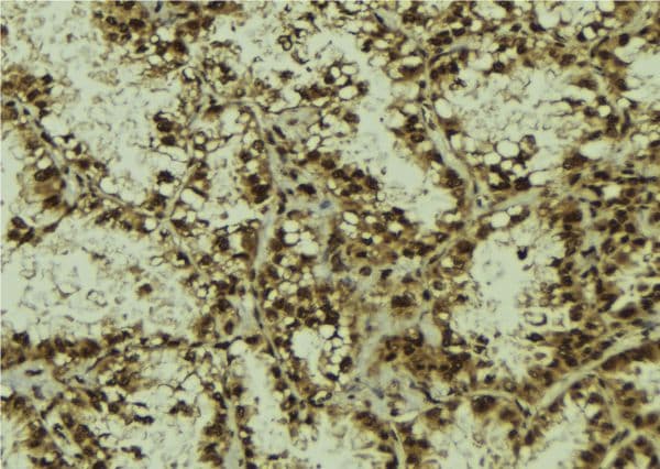 RASSF2 Antibody