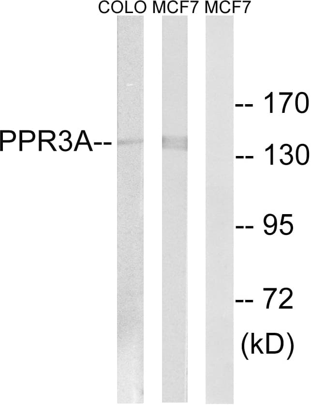 PPP1R3A / GM Antibody (aa647-696)
