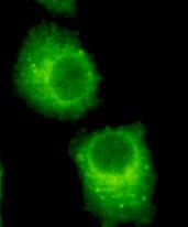 RAB2A / RAB2 Antibody (C-Terminus)