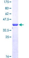 Human RNF146 Protein (Recombinant GST, N-terminus)