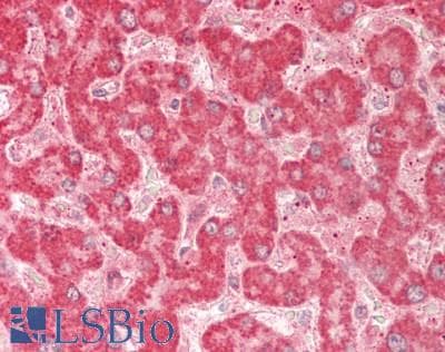 PathPlus™ RAB5A / RAB5 Antibody