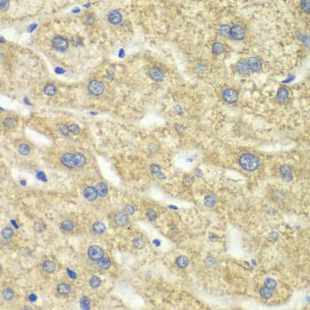 DLD / Diaphorase / E3 Antibody