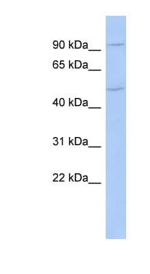 MAMLD1 Antibody (aa143-192)