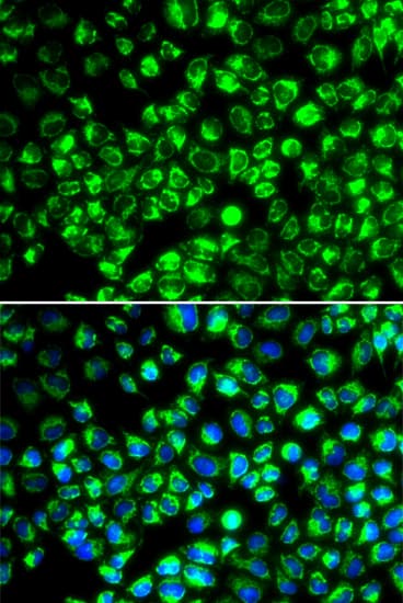 Polyclonal Rabbit anti-Human ATP6AP2 / Renin Receptor Antibody (IF, WB)