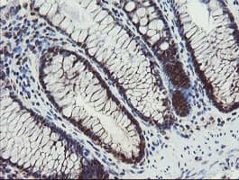 PPAT Antibody (aa42-278, clone OTI1B11)