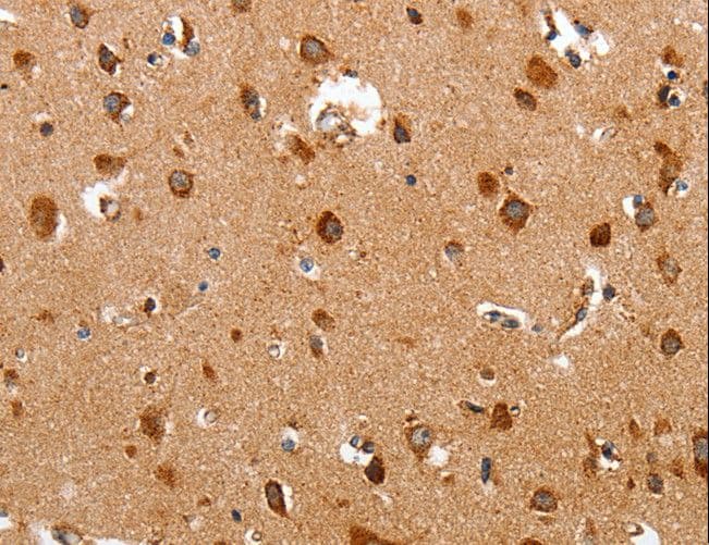 TRAP1 / HSP75 Antibody