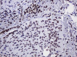 DCPS Antibody (clone OTI4H8)