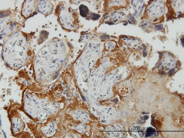 PLGLB2 / PLGLB1 Antibody (clone 3E6)