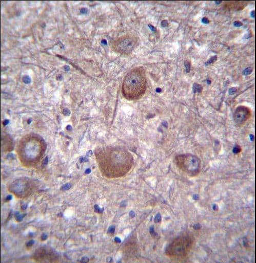 PPP3CC / CALNA3 Antibody (aa10-37)
