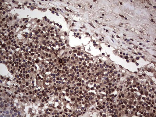 Monoclonal Mouse anti-Human SAE1 Antibody (clone OTI6B11, Carrier-free, IHC, WB)