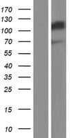 SND1 Protein (Over-Expression Lysate Myc-DDK (Flag))