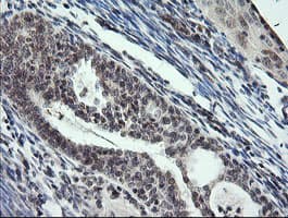 KIF25 Antibody (clone OTI2C9)