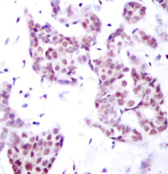 Polyclonal Rabbit anti-Human STAT6 Antibody (phospho-Tyr641, IHC, WB)