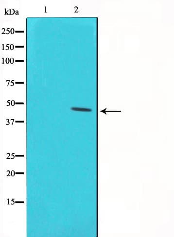 Polyclonal Rabbit anti-Human TP53 / p53 Antibody (phospho-Ser46, IF, WB)