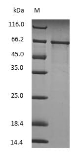 ALB / Serum Albumin Protein (Native)