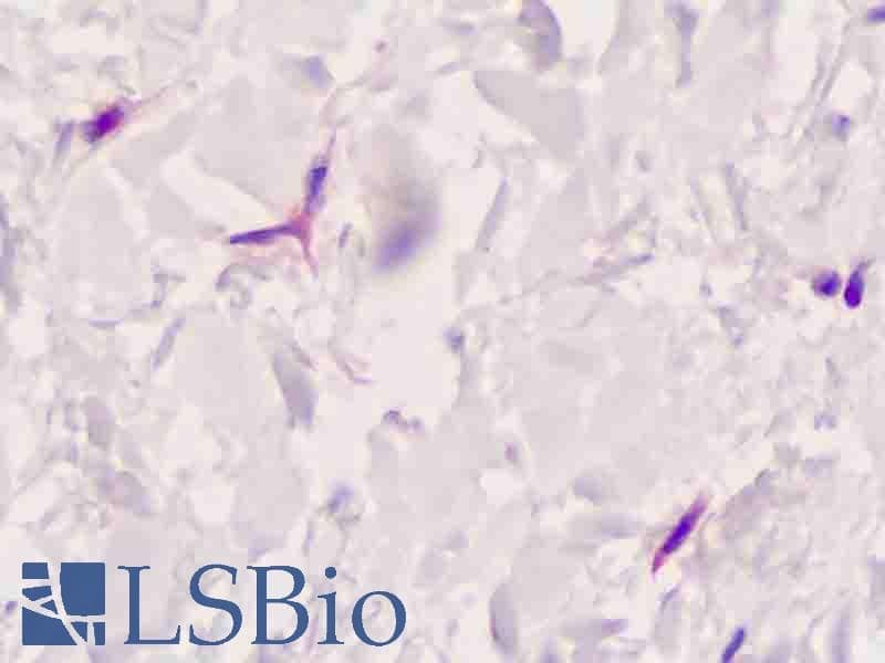 IHC-plus™ FAP Alpha Antibody (Extracellular Domain)