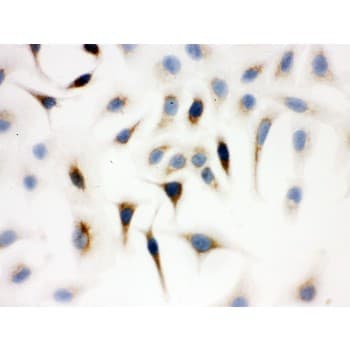 WAS / WASP Antibody (aa129-156)