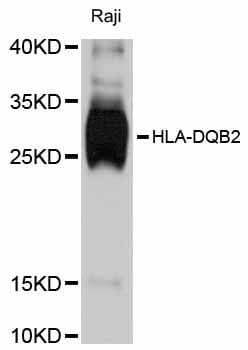 HLA-DQB2 Antibody
