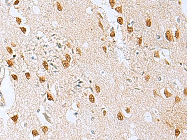KDM2B / FBXL10 Antibody