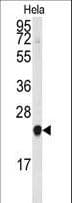 IHC-plus™ PEBP1 / RKIP Antibody (aa1-30)
