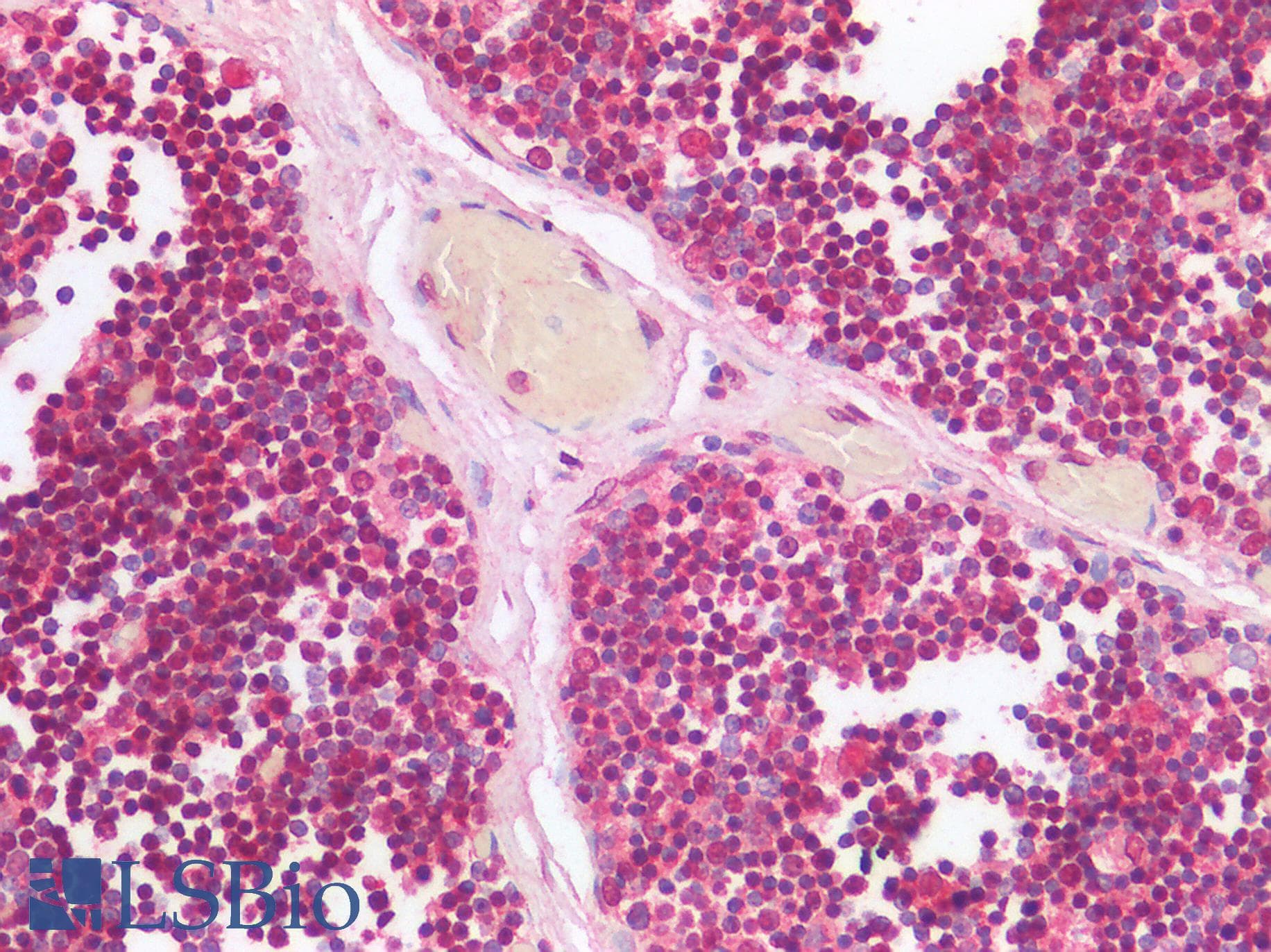 IHC-plus™ Polyclonal Rabbit anti-Human TIGIT Antibody (IHC)