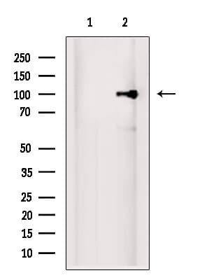 EXOSC10 Antibody