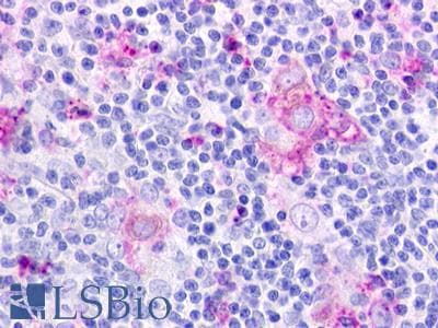 PathPlus™ CHEMR23 / CMKLR1 Antibody (N-Terminus)