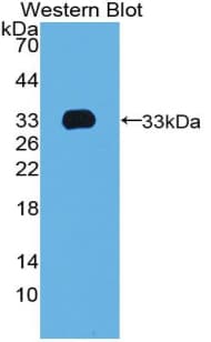 TBX4 Antibody (aa284-545, PE)