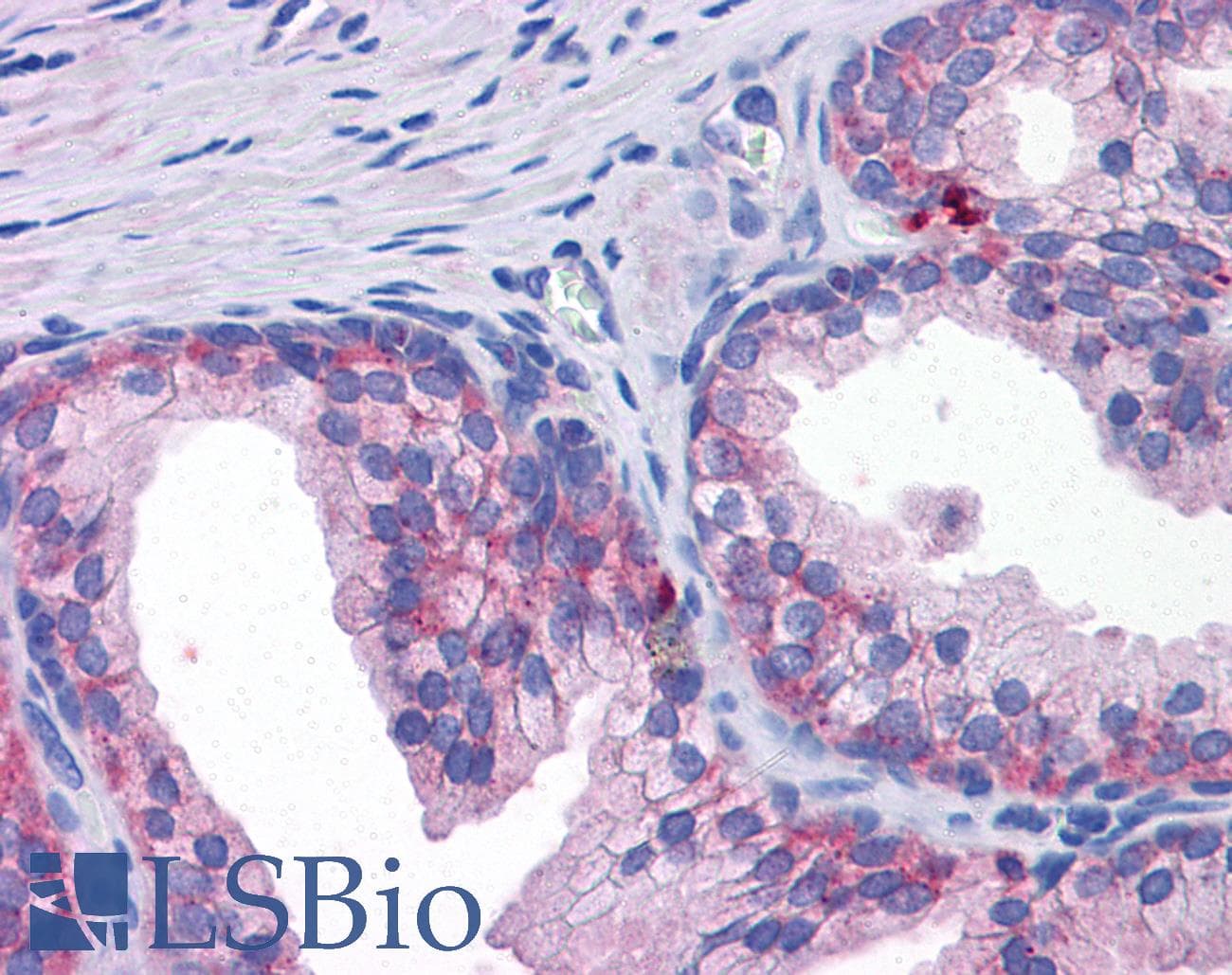 IHC-plus™ SLC39A3 / ZIP3 Antibody