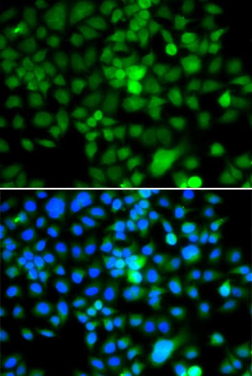 NAP1L3 Antibody