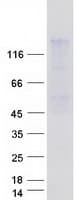 Human TIMELESS Protein (Recombinant Myc-DDK (Flag))