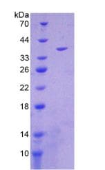 Human MT-ND1 Protein (Recombinant His-GST)