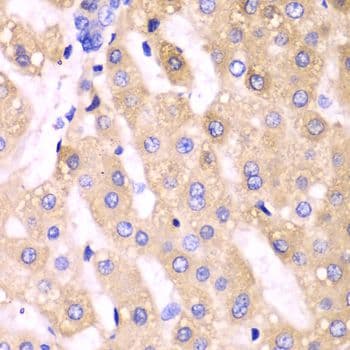 CYP3A4 / Cytochrome P450 3A4 Antibody