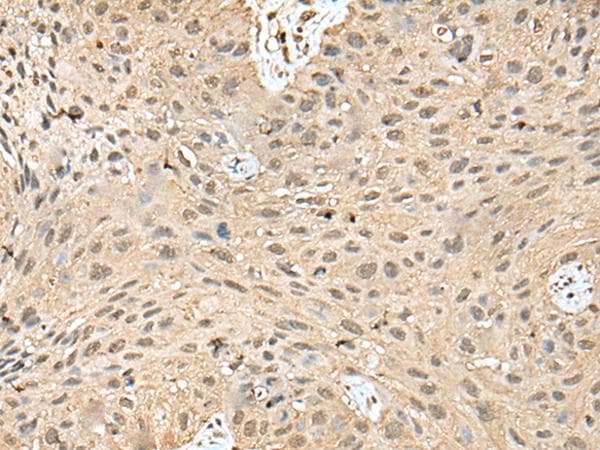 Polyclonal Rabbit anti-Human ATXN3 / JOS Antibody (IHC)