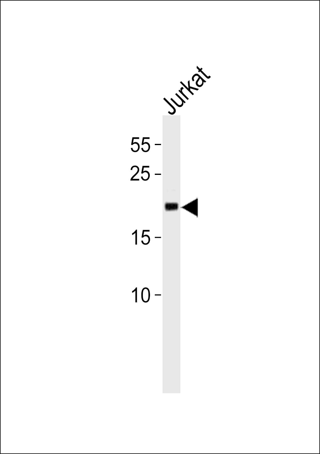 MGMT Antibody (aa156-182)