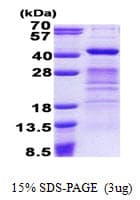 Human DPPA4 Protein (Recombinant His)