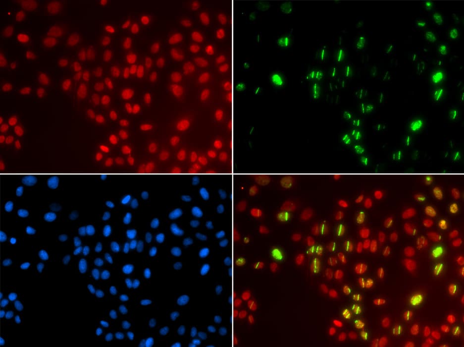 POLH / DNA Polymerase Eta Antibody