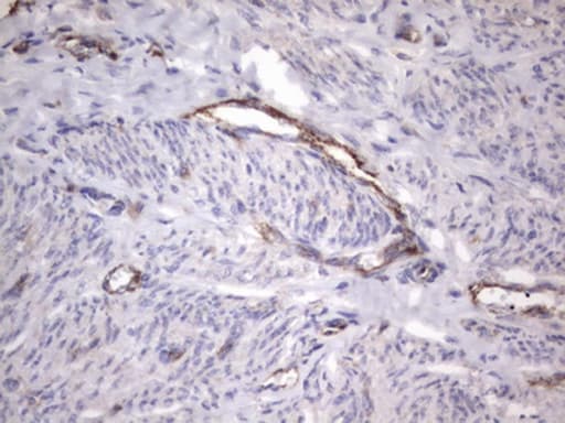 VWF / Von Willebrand Factor Antibody (aa764-1263, clone OTI2H9)