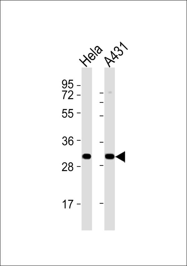 Polyclonal Rabbit anti-Human RPS4X + RPS4Y1 + RPS Antibody (WB)