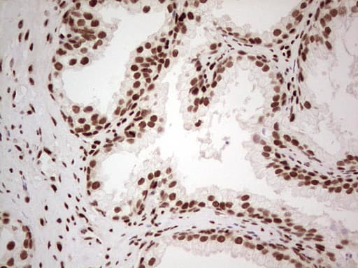 NR3C1/Glucocorticoid Receptor Antibody (aa1-265, clone OTI6A12)