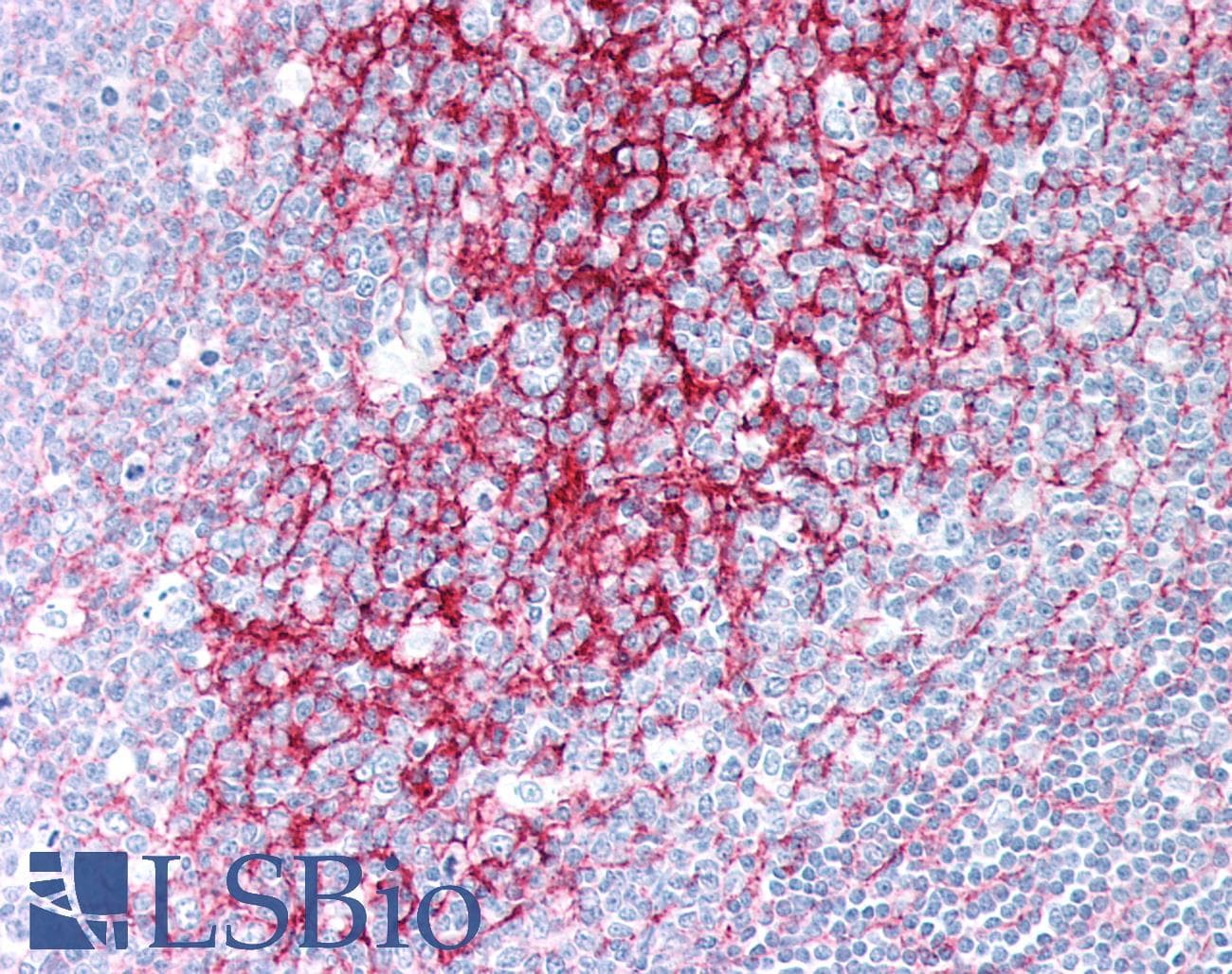 PathPlus™ Monoclonal Mouse anti-Human CR1 / CD35 Antibody (IHC)