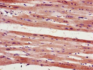 Polyclonal Rabbit anti-Human FHL2 Antibody (IHC, IF)