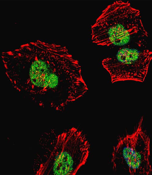 NCL / Nucleolin Antibody (aa428-455)