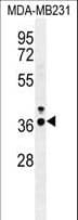 IHC-plus™ IRF1 / MAR Antibody (aa74-102)