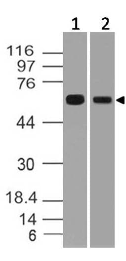 RGS11 Antibody