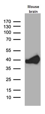 SEPT3 / Septin 3 Antibody (clone OTI1D10)