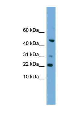 Polyclonal Rabbit anti-Human RAC1 Antibody (C-Terminus, IHC, WB)