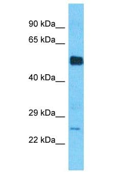 Polyclonal Rabbit anti-Human ECI1 / DCI Antibody (aa183-232, WB)